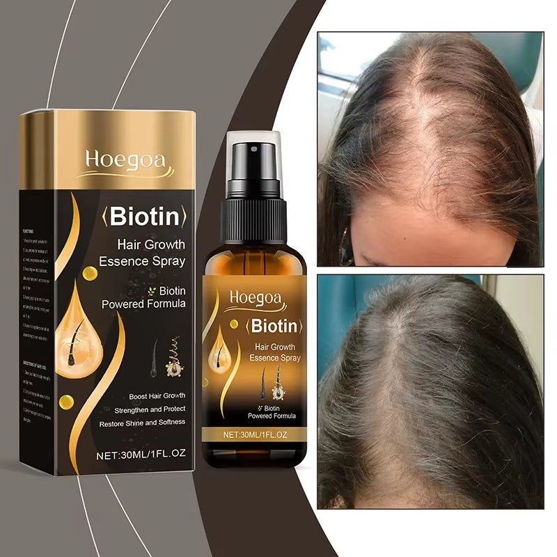 Biotin Fast Hair Growth Spray anti Hair Loss Serum Prevent Baldness Treatment Scalp Beard Beauty Essence Hair Care Products 30Ml