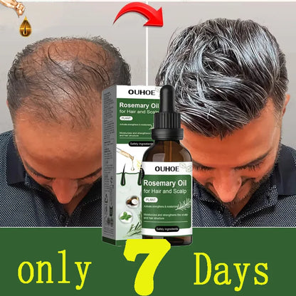 Rosemary Hair Growth Oil anti Hairs Loss Treatment Mint Hair Strengthening Oil Nourishing Roots Regrowth Hair for Men Women 50Ml