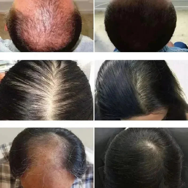 Rosemary Hair Growth Oil anti Hairs Loss Treatment Mint Hair Strengthening Oil Nourishing Roots Regrowth Hair for Men Women 50Ml