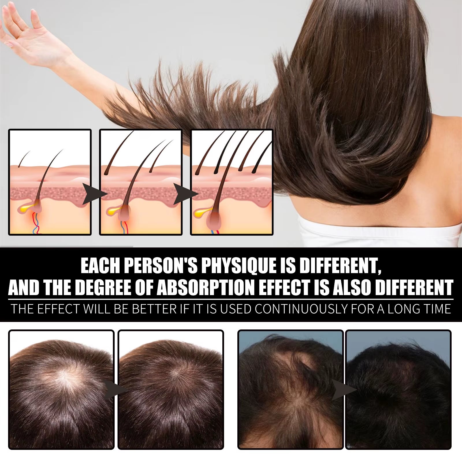 Collagen B7 Vitamin Hair Care Essential Oil Nourish Scalp Preventing Hair Loss Stabilizing Hair Roots Protecting Hair Follicles